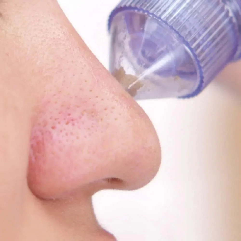4 in 1 Vacuum Pore Cleaning Device - Image 3