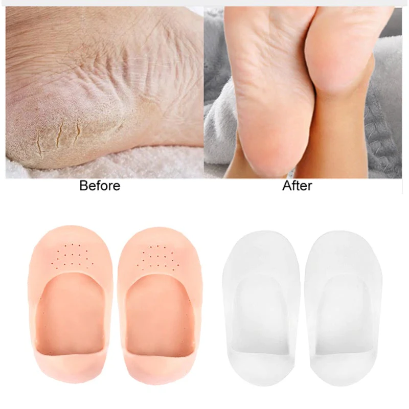 Anti-Crack Heel Silicone Full Socks - Image 3